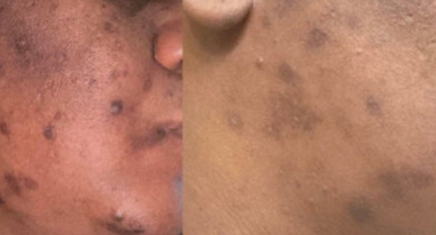 🌿 Turmeric Brightening Soap